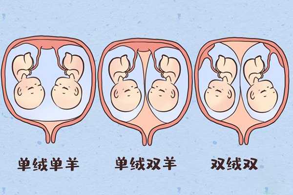 试管双胞胎长得不像有原因，同卵or异卵看完就明白